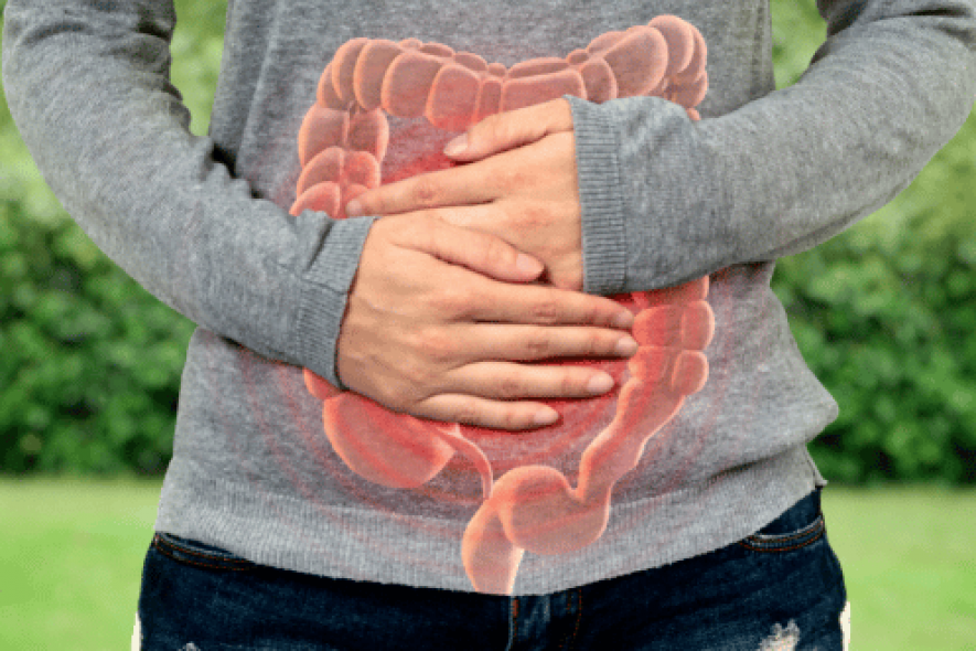 Síndrome del Intestino Irritable (permeable) – Leaky out