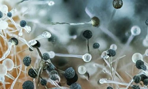 Cuidado de la Microbiota intestinal en pacientes con Biopolímeros