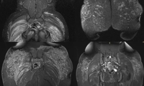 La importancia de la Resonancia Magnética en la extracción de biopolímeros