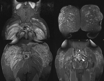 Importancia de la Resonancia Magnética en la extracción de biopolímeros