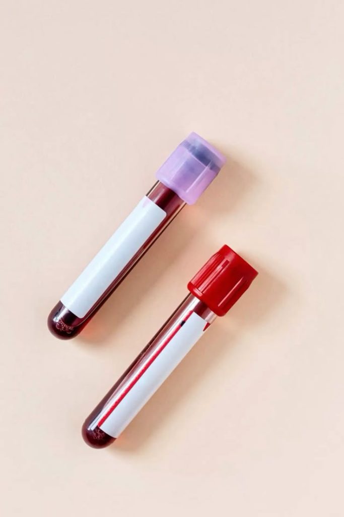 El papel de la medicina regenerativa en pacientes con biopolímeros en glúteos