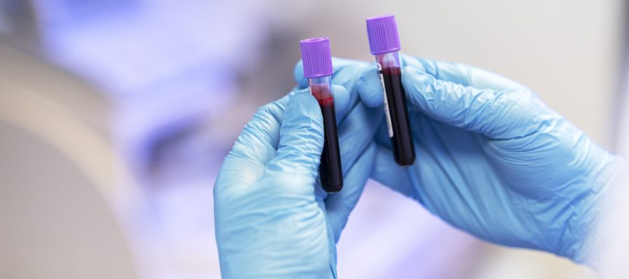 Exámenes preoperatorios básicos Estos estudios ayudan a confirmar que el organismo está en condiciones seguras para la intervención y a disminuir los riesgos